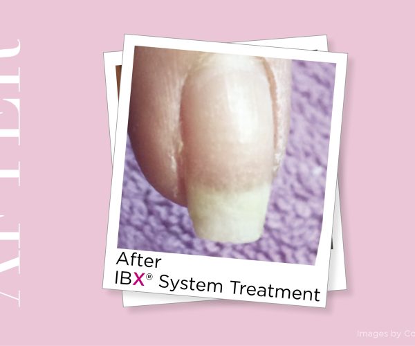 сертифициран салон за работа с IBX system за увредени нокти